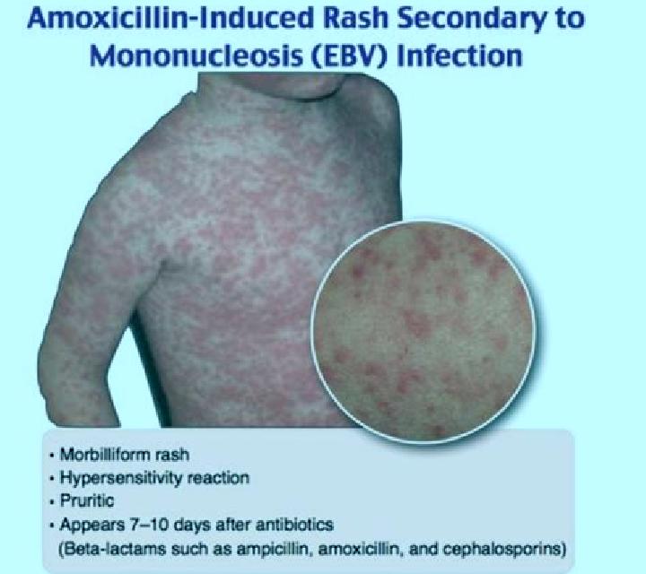 escort Loeberoed