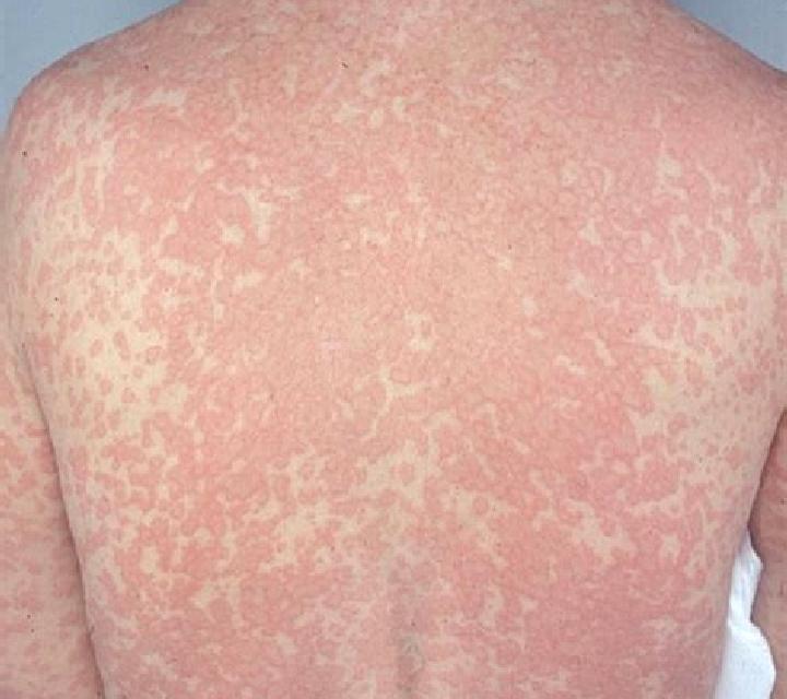 escort Moberly